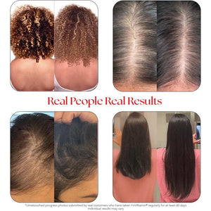 Hairtamin Advanced Hair & Scalp Serum Pack | All-Natural Vegan Biotin Capsules & Serum Sample for Hair, Skin & Nail Growth