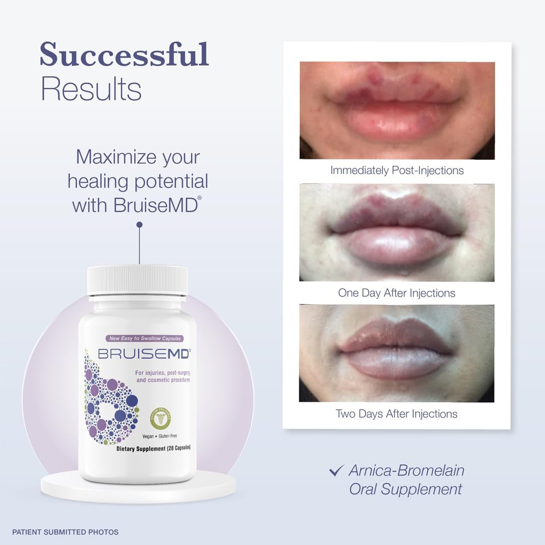 Arnica 1,000Mg and Bromelain 500Mg 2,400Gdu/G Supplement for Bruising and Swelling (7-Day Supply)