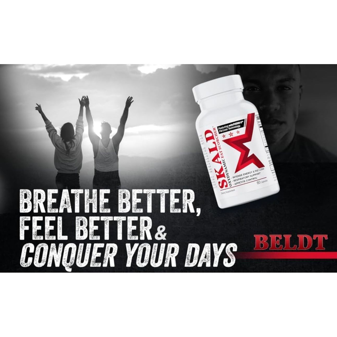 Skald Oxydynamic Fat Scorcher - for Weight Loss - Thermogenic Fat Burner