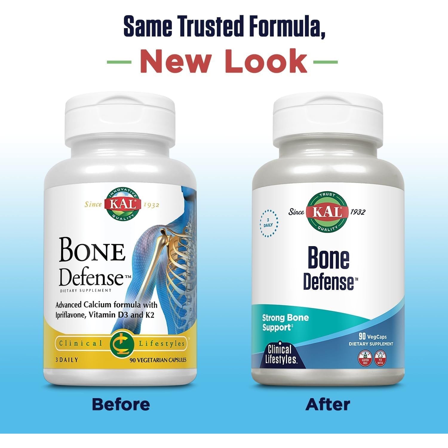 KAL Bone Defense | Healthy Bone Strength and Density Supplement 30 Servings