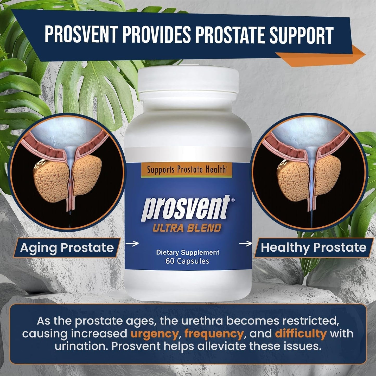 Advanced Prostate Support Ultra to Ease Urinary Frequency & Urgency (60 Count)