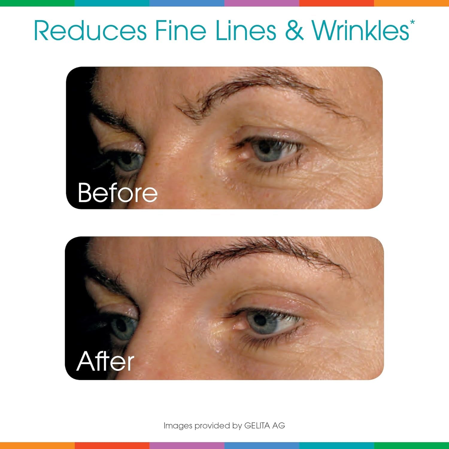 Sparkle Wellness Skin Boost plus (No Flavor) | Collagen Powder Supplement [30-Servings]