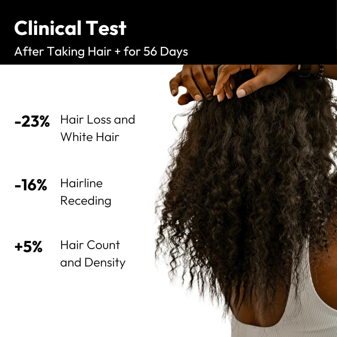 Bigvita Hair Growth Supplement, Lab Tested for Thicker, Fuller Hair, Faster Growth with Anagain 1 Month Supply